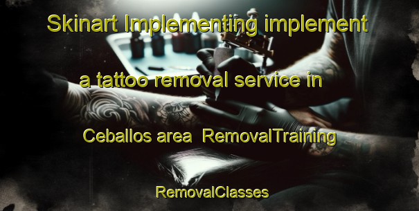 Skinart Implementing implement a tattoo removal service in Ceballos area | RemovalTraining | RemovalClasses | SkinartTraining-Argentina