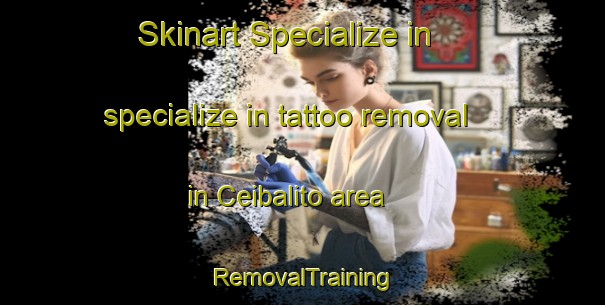 Skinart Specialize in specialize in tattoo removal in Ceibalito area | RemovalTraining | RemovalClasses | SkinartTraining-Argentina