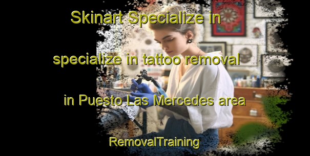 Skinart Specialize in specialize in tattoo removal in Puesto Las Mercedes area | RemovalTraining | RemovalClasses | SkinartTraining-Argentina