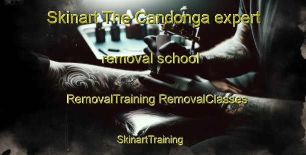 Skinart The Candonga expert removal school | #RemovalTraining #RemovalClasses #SkinartTraining-Argentina