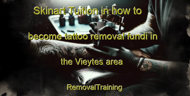 Skinart Tuition in how to become tattoo removal fundi in the Vieytes area | RemovalTraining | RemovalClasses | SkinartTraining-Argentina
