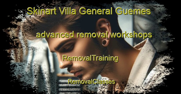 Skinart Villa General Guemes advanced removal workshops | RemovalTraining | RemovalClasses | SkinartTraining-Argentina